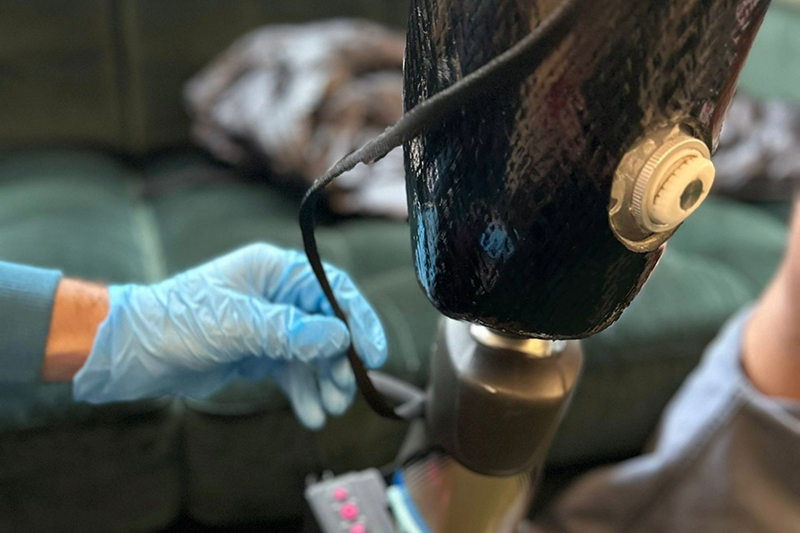 blue gloved hand on the left of the image touches a wire on a prosthetic leg, wire and top of leg are black
