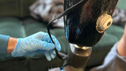 MW May 2025 p16_Prosthetics technology_for web.jpg