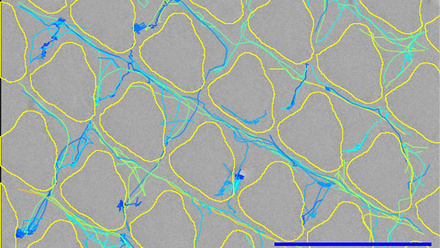 Bacteria at 2 mins.jpg