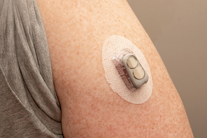 A small device on someone's arm that is made of see through plastic with two flat batteries inside and electronics underneath, where it sits on top of an oval plaster-like surface